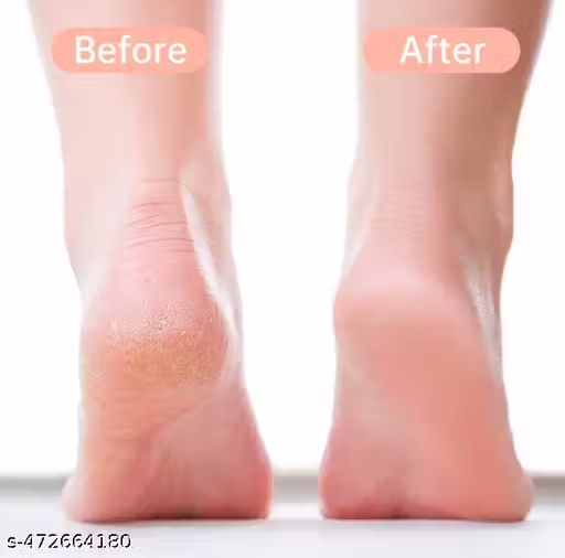 gecsl_512 – Rapple